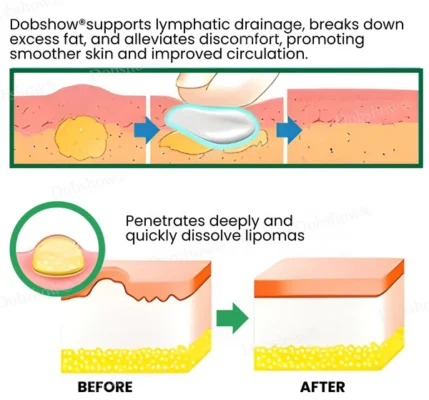 Dobshow® Lymphatic Detox Herbal Cream