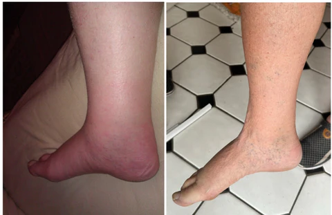 Dobshow® Lymphatic Detox Herbal Cream
