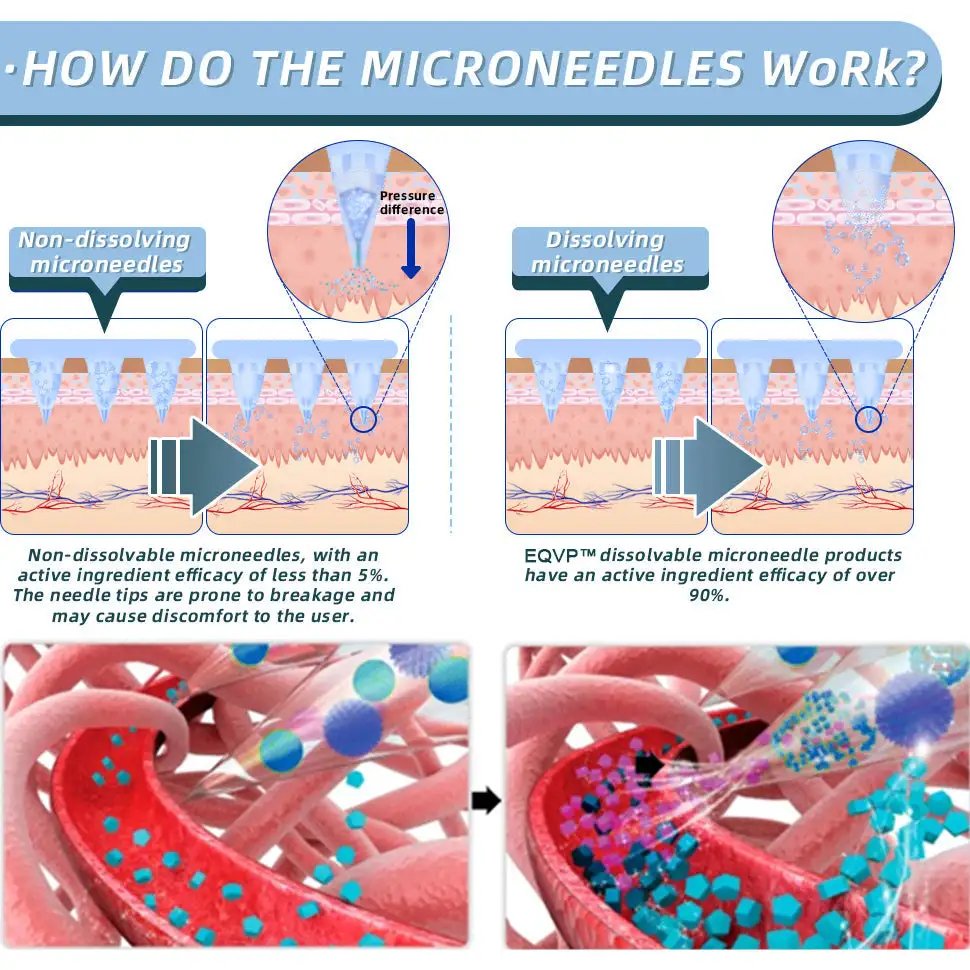 EQVP® Hyaluronic Acid Nano-microneedle joint patch