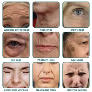 Flysmus® Botox Jellyfish Venom Peptide Nanoliposome Sculpting Anti-Wrinkle Cream