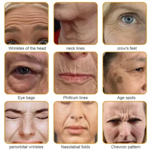 Flysmus™ Botox Jellyfish Venom Peptide Nanoliposome Sculpting Anti-Wrinkle Cream
