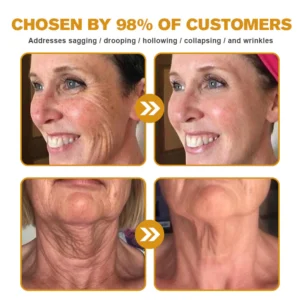 Flysmus™ Botox Jellyfish Venom Peptide Nanoliposome Sculpting Anti-Wrinkle Cream