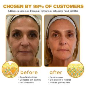 Flysmus™ Botox Jellyfish Venom Peptide Nanoliposome Sculpting Anti-Wrinkle Cream
