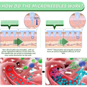 Honxi™ SMGT-GLP-1 Nano Microneedle Patch（Painless, long-lasting, addressing diabetes, obesity, and cardiovascular diseases)