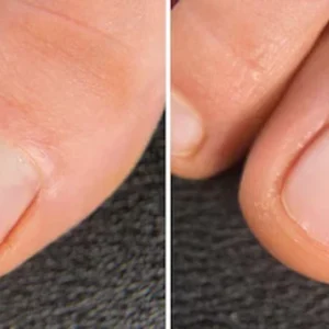 LIMETOW® BeeVenom Anti-Fungal Nail Renewal Oil