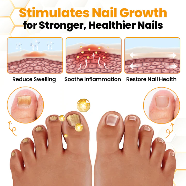 LIMETOW® BeeVenom Anti-Fungal Nail Renewal Oil