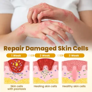 LOVILDS™ Bee Derma Repair Cream