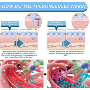 Lmipki® SMGT-GLP-1 Nano Microneedle Patch