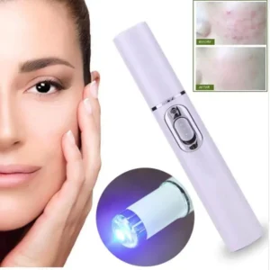 Lovilds® Non-Invasive Mole and Wart Removal Laser Pen