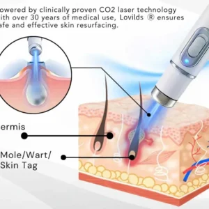 Lovilds® Non-Invasive Mole and Wart Removal Laser Pen