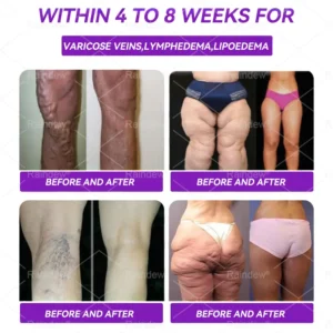 Official Store | Raindew® 𝐆𝐋𝐏-𝟏 𝐨𝐫𝐚𝐥 𝐥𝐢𝐪𝐮𝐢𝐝--✅Revolutionary GLP-1 Scientific Sugar Control and Weight Loss Programs