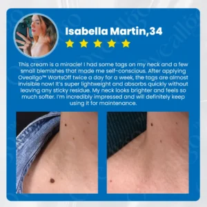 Oveallgo™ Ultra WartsOff Instant Blemish Removal Cream