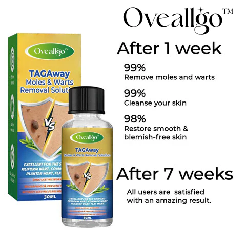 Oveallgo™ TAGAway Moles & Warts Removal Solution