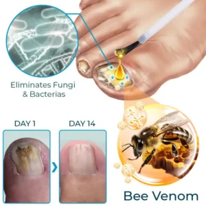 SEURICO™ Bee Venom Deep Repair Nail Essence | Powerful Antifungal & Nail Strengthening Solution