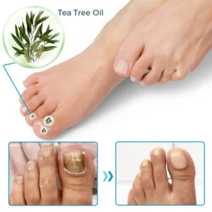 SEURICO™ Bee Venom Deep Repair Nail Essence | Powerful Antifungal & Nail Strengthening Solution