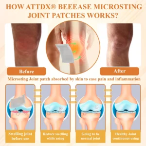 ATTDX® BeeEase MicroSting Joint Patches
