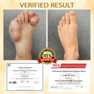ATTDX® BeeEase MicroSting Joint Patches