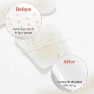 ATTDX® BeeEase MicroSting Joint Patches