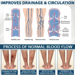 ATTDX® MicroSting Black Cumin Edema Patch