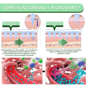 Cvreoz® Cerotto con microaghi nano SMGT-GLP-1