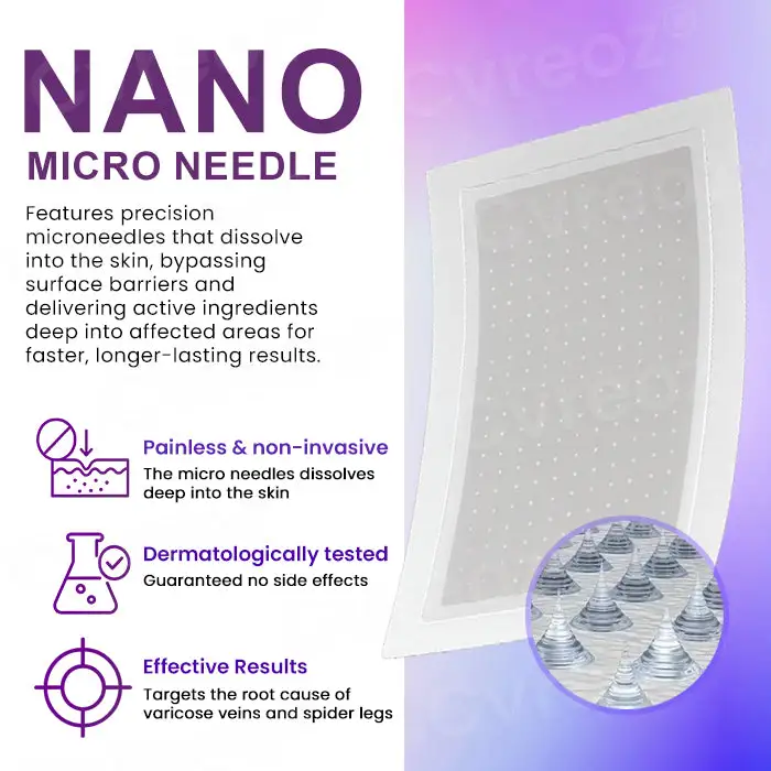 Cvreoz® Polidocanol Nano Patches for Varicose Veins