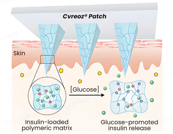 Cvreoz® InsuliNeedle Glucose Control Microneedling Patch