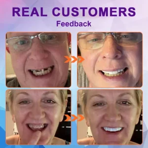 Experience Comfort with LOVILDS™ Silicone Lined Denture Set - (ADA Recommended)
