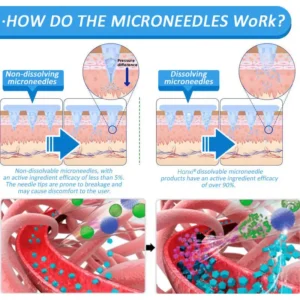 Honxi® GLP-1 Nano Microneedle Patch（Painless, long-lasting, addressing diabetes, obesity, and cardiovascular diseases）