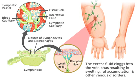 LOVILDS™ Navel pill slimming patch