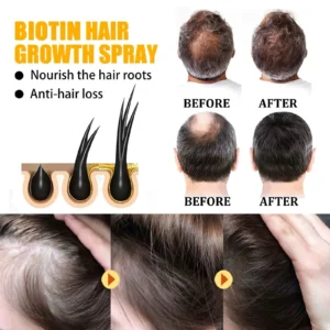 Lovilds™ Biotin Premium Hair Growth Serum