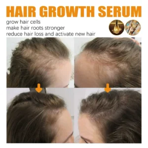 Lovilds™ Biotin Premium Hair Growth Serum