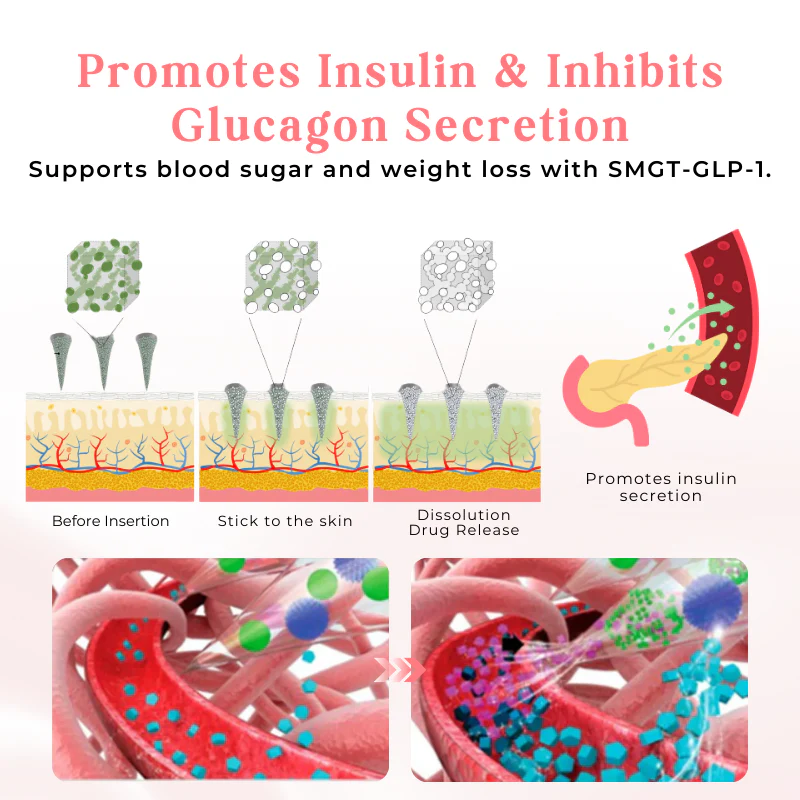 Newyuo™ GLP-1 Microneedle Patch