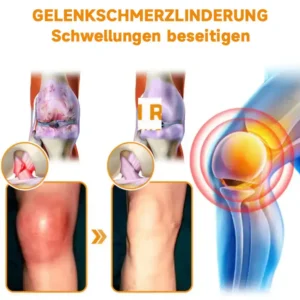 Ourlyard® Magnesiumöl & Bienengift-Gelenk-Heilspray Lindert Gelenkschmerzen in nur 4 Wochen – ganz ohne Rückfall-Effekt