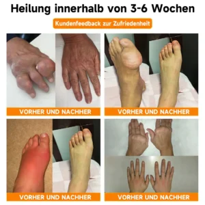 Ourlyard® Magnesiumöl & Bienengift-Gelenk-Heilspray Lindert Gelenkschmerzen in nur 4 Wochen – ganz ohne Rückfall-Effekt
