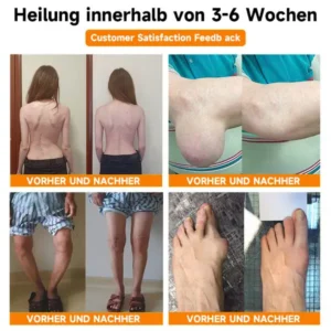 Ourlyard® Magnesiumöl & Bienengift-Gelenk-Heilspray Lindert Gelenkschmerzen in nur 4 Wochen – ganz ohne Rückfall-Effekt