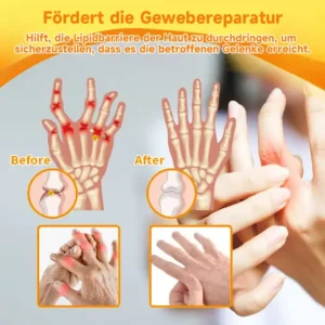 Ourlyard® Magnesiumöl & Bienengift-Gelenk-Heilspray Lindert Gelenkschmerzen in nur 4 Wochen – ganz ohne Rückfall-Effekt