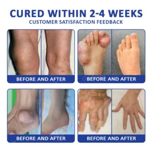 Ourlyard® Marine Sting & Emu Oil Arthritis Soothing Gel (FDA Approved)
