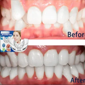 Vaxflite™Mandibular Corrector-For a Healthier, More Aligned Smile