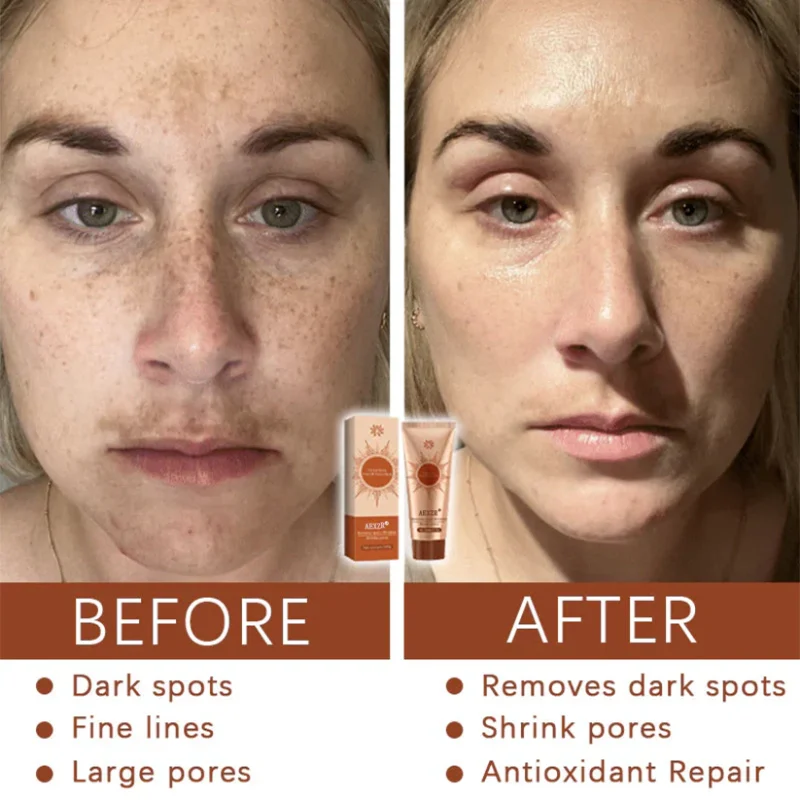 Winter Sale AEXZR® Herbal Spots Peel-Off Facial Mask