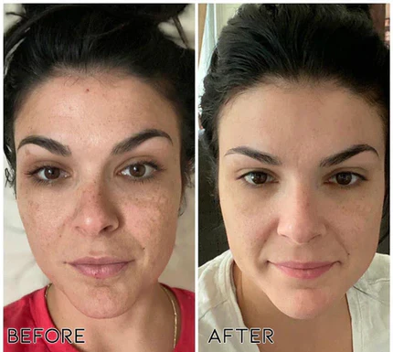 Winter Sale AEXZR® Herbal Spots Peel-Off Facial Mask