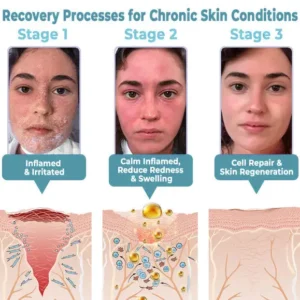 coastglee™ Soothe Tag & Mole Clear Gel (FDA Approved)