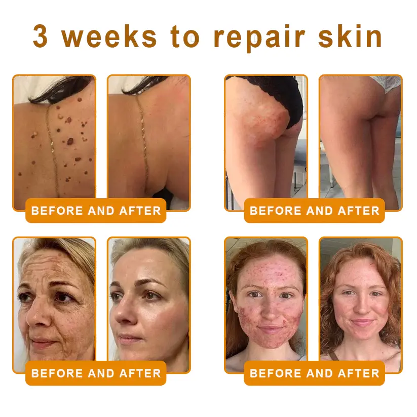 Alisanda® "Dermal Gold" Botulin Bee Poison Skin Restoration Cream