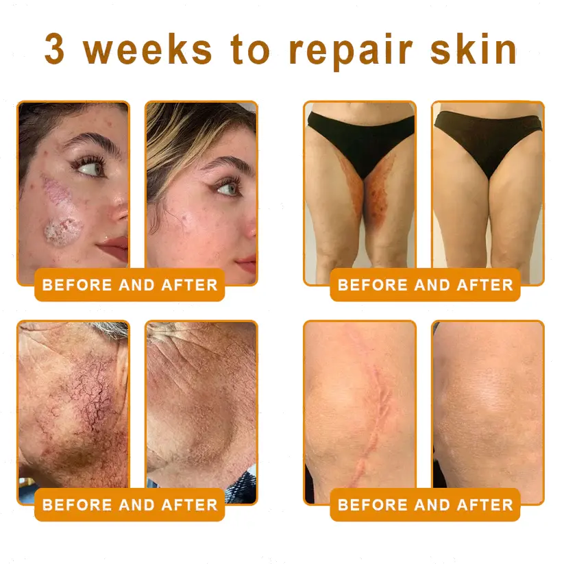 Alisanda® "Dermal Gold" Botulin Bee Poison Skin Restoration Cream
