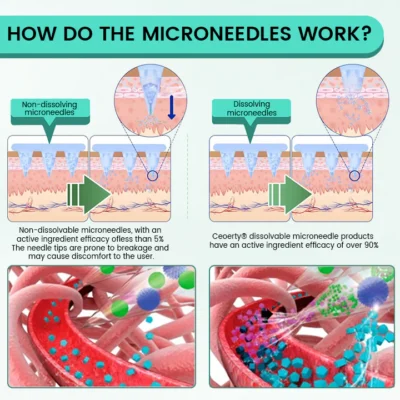 Ceoerty® Slimura GLP-1 Nano Microneedle Patch