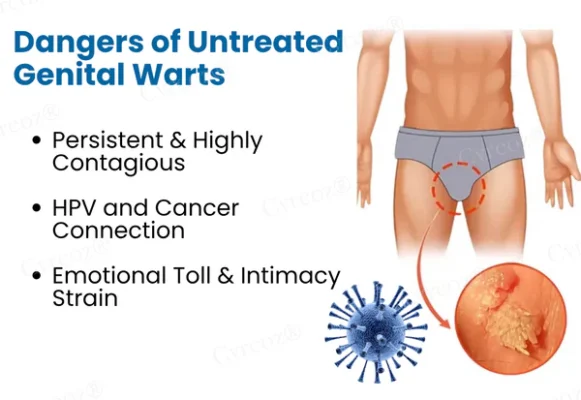 Cvreoz® HPV Genital Warts Relief Cream