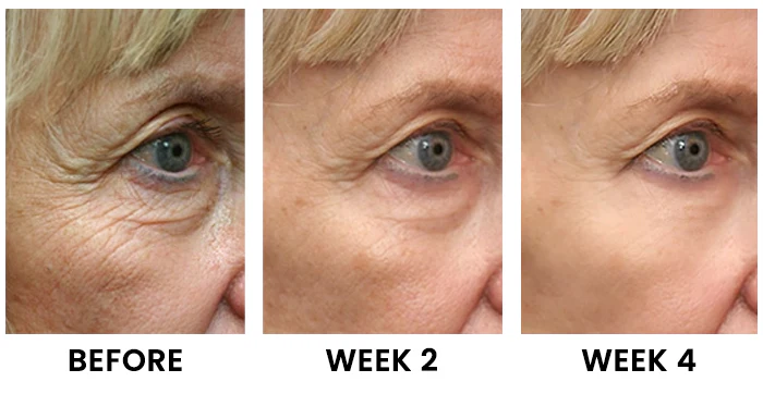 Dobshow® Botox Bee Venom Anti-wrinkle Cream