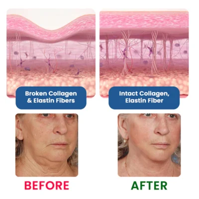 Dobshow® Botox Bee Venom Anti-wrinkle Cream