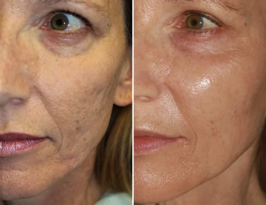 Juxek™ Astaxanthin + Peptide Firming Ampoule