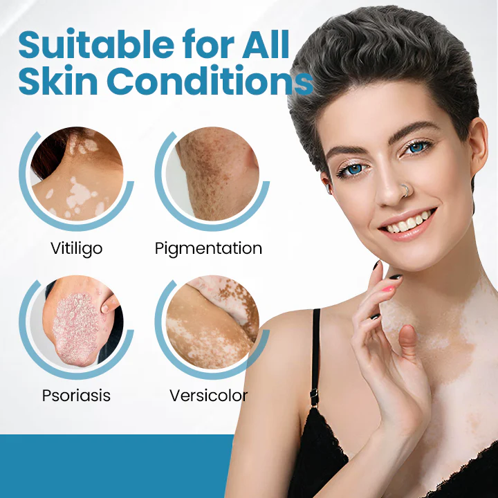 Nurbini® Dermiglow Vitiligo Therapy device