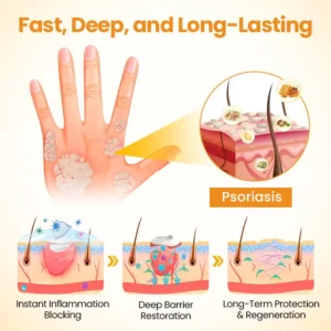 ATTDX® BeeSooth Psoriasis Skin Care Cream